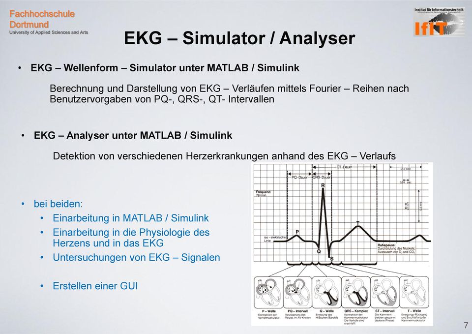 Simulink Detektion von verschiedenen Herzerkrankungen anhand des EKG Verlaufs bei beiden: Einarbeitung in MATLAB /