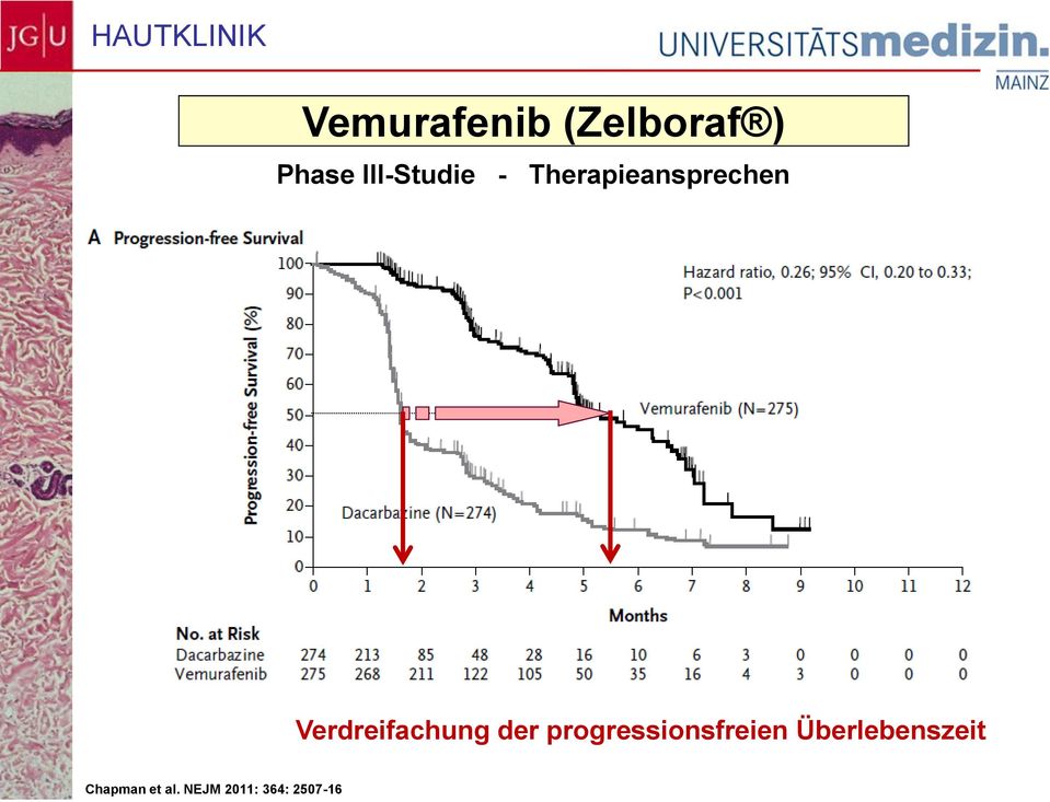 Verdreifachung der progressionsfreien