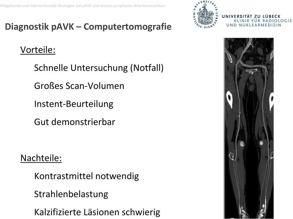 Instent-Beurteilung Gut demonstrierbar Nachteile: