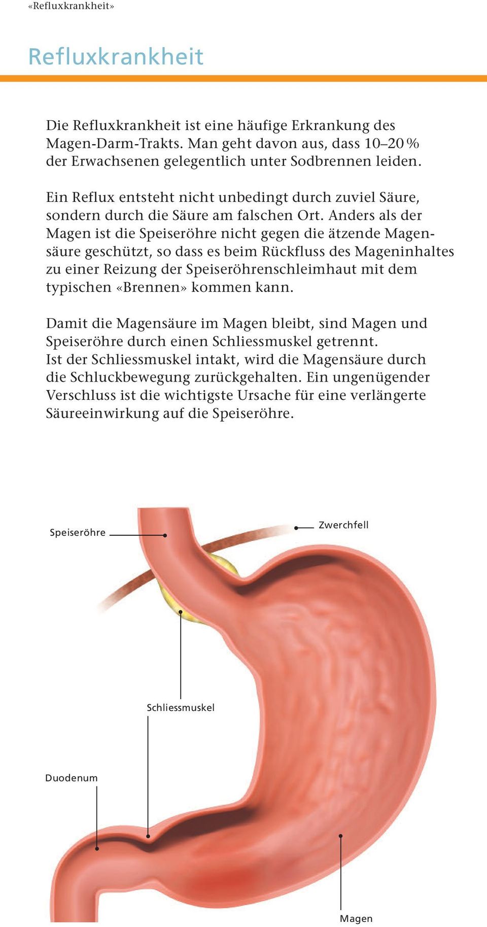 Anders als der Magen ist die Speiseröhre nicht gegen die ätzende Magen - säure geschützt, so dass es beim Rückfluss des Mageninhaltes zu einer Reizung der Speiseröhrenschleimhaut mit dem typischen