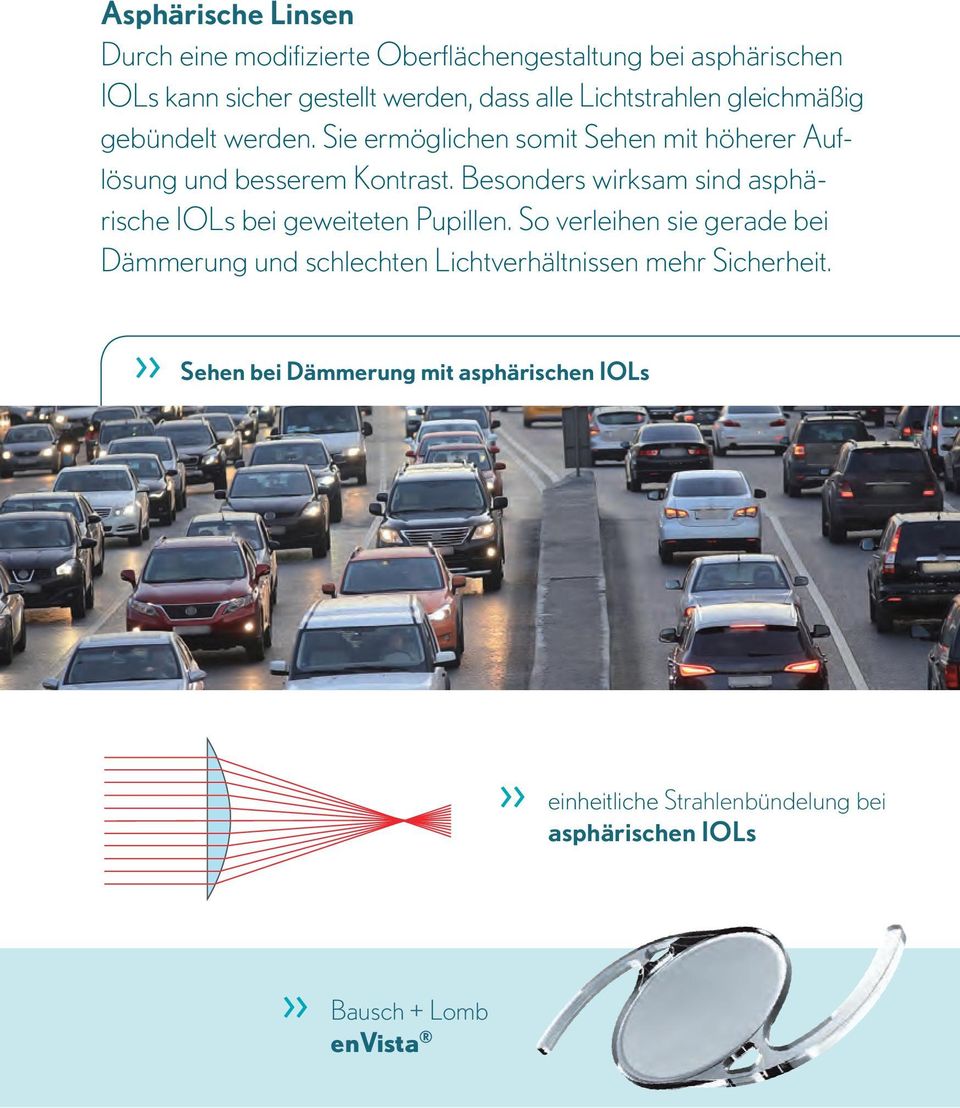 Besonders wirksam sind asphärische IOLs bei geweiteten Pupillen.