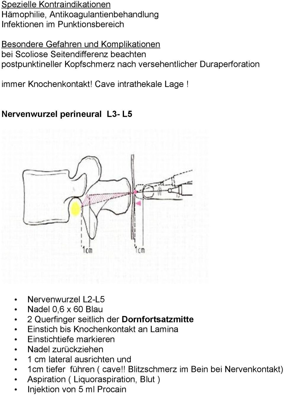 Nervenwurzel perineural L3- L5 Nervenwurzel L2-L5 Nadel 0,6 x 60 Blau 2 Querfinger seitlich der Dornfortsatzmitte Einstich bis Knochenkontakt an Lamina
