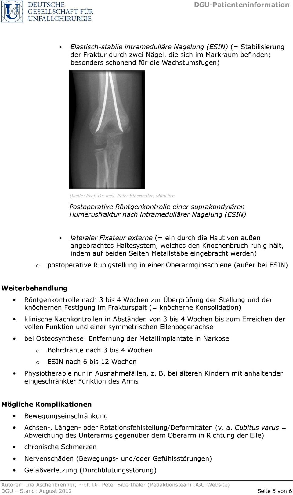 Peter Biberthaler, München Pstperative Röntgenkntrlle einer suprakndylären Humerusfraktur nach intramedullärer Nagelung (ESIN) lateraler Fixateur externe (= ein durch die Haut vn außen angebrachtes