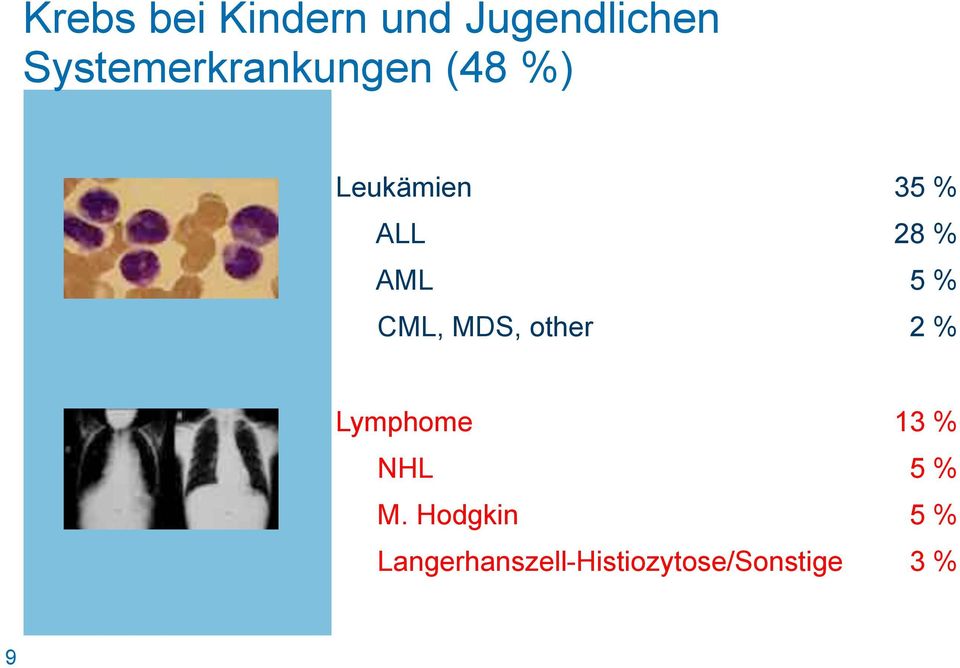 % AML 5 % CML, MDS, other 2 % Lymphome 13 % NHL