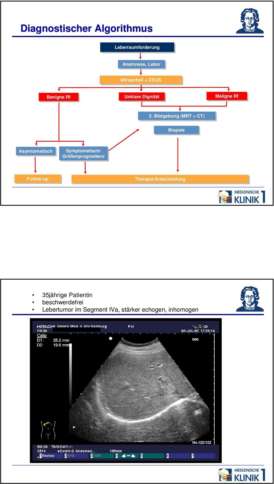 2. Bildgebung (MRT > CT) Biopsie Asymtomatisch Symptomatisch/ Größenprogredienz