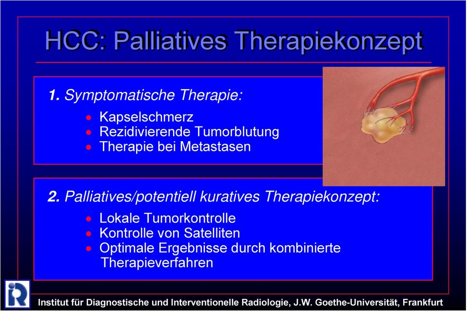 Therapie bei Metastasen 2.
