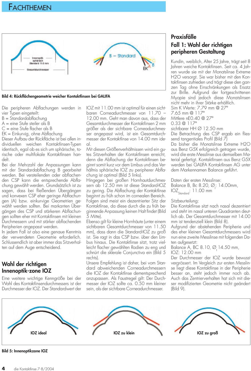 identisch, egal ob es sich um sphärische, torische oder multifokale Kontaktlinsen handelt. Bei der Mehrzahl der Anpassungen kann mit der Standardabflachung B gearbeitet werden.