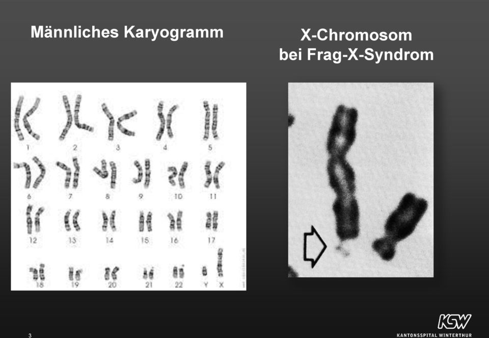 X-Chromosom