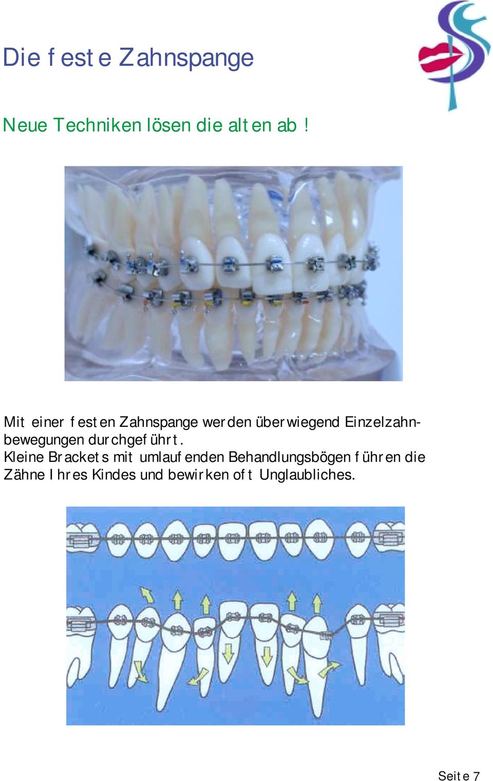 Einzelzahnbewegungen durchgeführt.