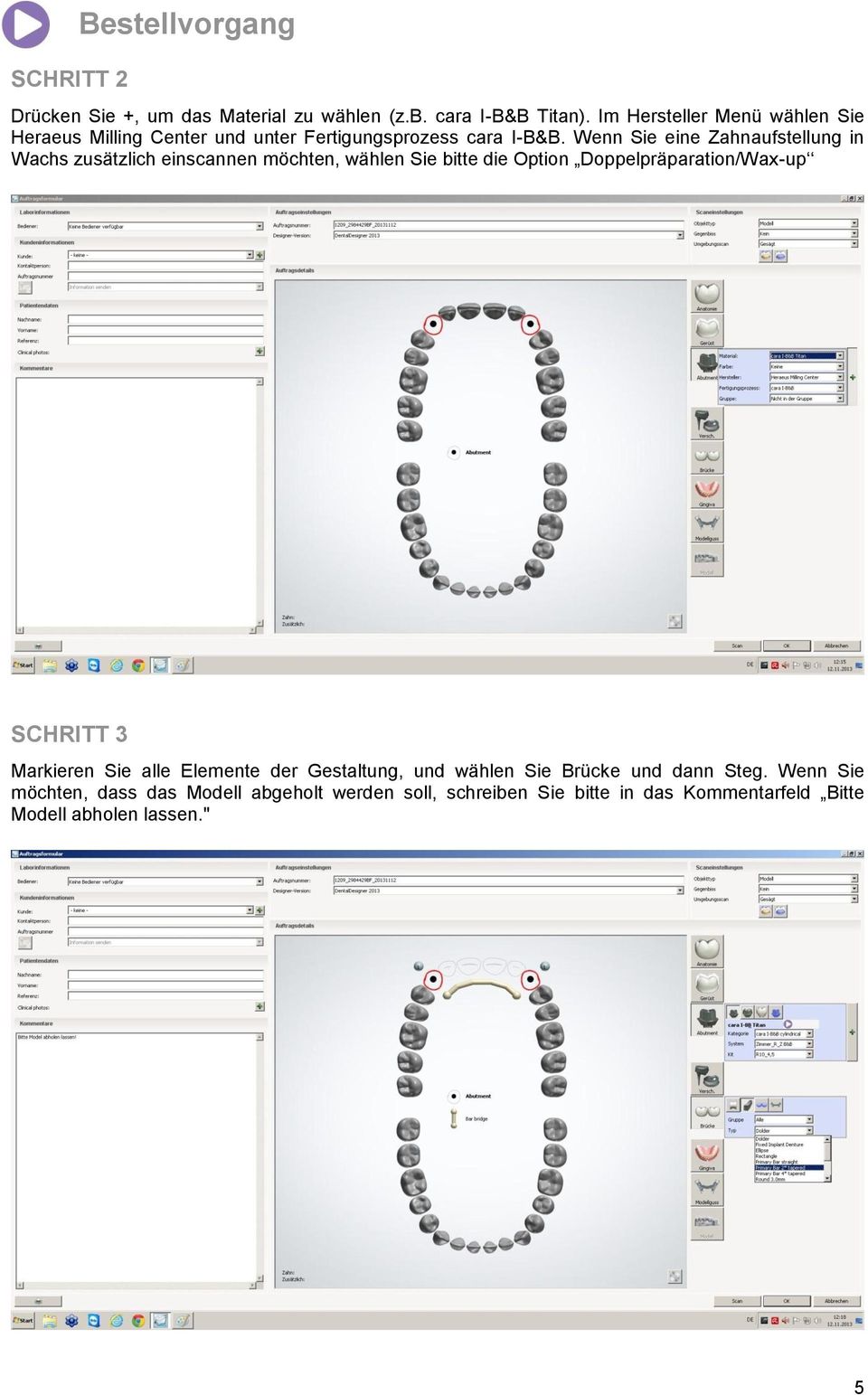 Wenn Sie eine Zahnaufstellung in Wachs zusätzlich einscannen möchten, wählen Sie bitte die Option Doppelpräparation/Wax-up SCHRITT