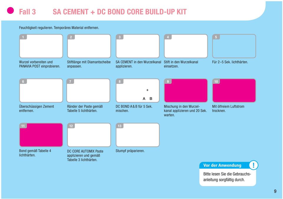 6 7 8 9 10 Überschüssigen Zement entfernen. Ränder der Paste gemäß Tabelle 5 lichthärten. DC BOND A & B für 5 Sek. mischen. Mischung in den Wurzelkanal applizieren und warten.