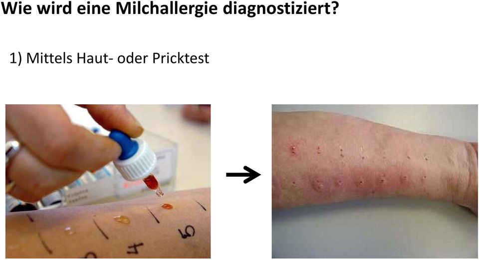 diagnostiziert?