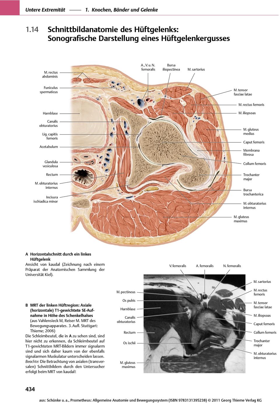 iliopsoas Caput Membrana fibrosa Collum major trochanterica internus maximus A Horizontalschnitt durch ein linkes Hüftgelenk Ansicht von kaudal (Zeichnung nach einem Präparat der Anatomischen