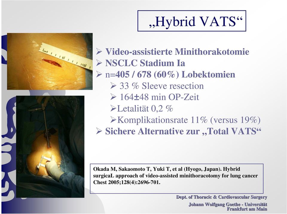 Sichere Alternative zur Total VATS Okada M, Sakaomoto T, Yuki T, et al (Hyogo, Japan).