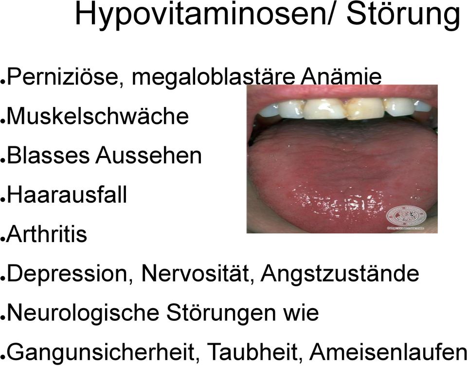 Arthritis Depression, Nervosität, Angstzustände