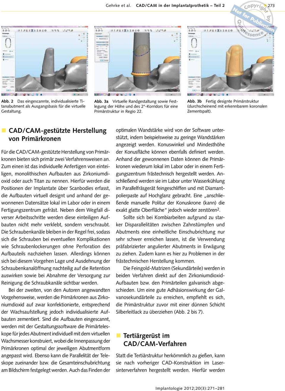 CAD/CAM-gestützte Herstellung von Primärkronen Für die CAD/CAM-gestützte Herstellung von Primärkronen bieten sich primär zwei Verfahrensweisen an.