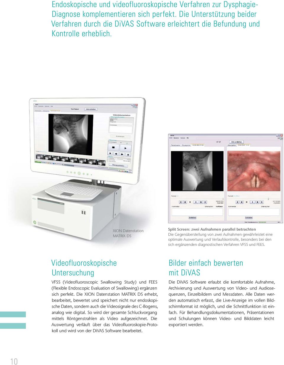 XION Datenstation MATRIX DS Split Screen: zwei Aufnahmen parallel betrachten Die Gegenüberstellung von zwei Aufnahmen gewährleistet eine optimale Auswertung und Verlaufskontrolle, besonders bei den