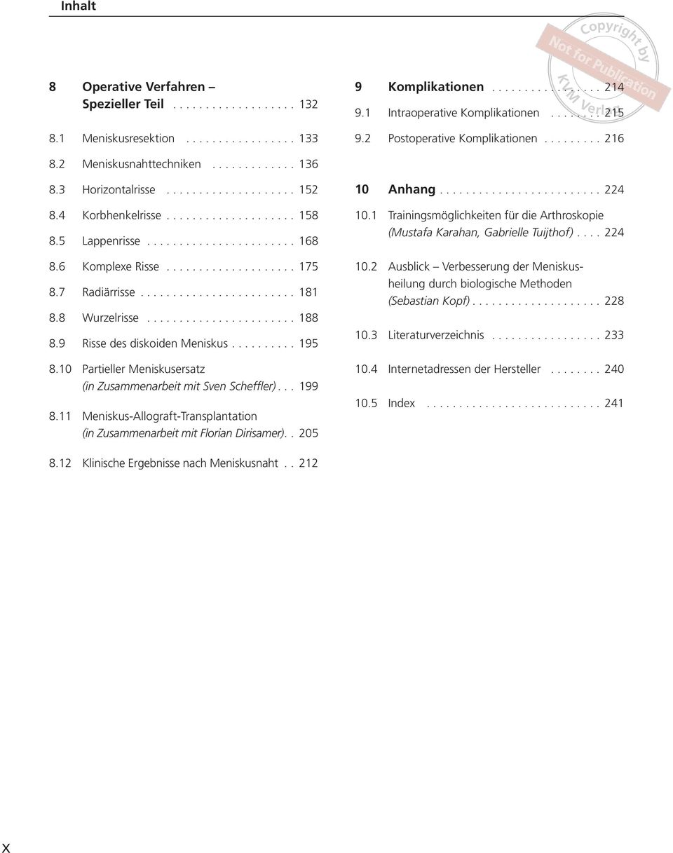 9 Risse des diskoiden eniskus... 195 8.10 Partieller eniskusersatz (in Zusammenarbeit mit Sven Scheffler)... 199 8.11 eniskus-allograft-translantation (in Zusammenarbeit mit Florian Dirisamer).