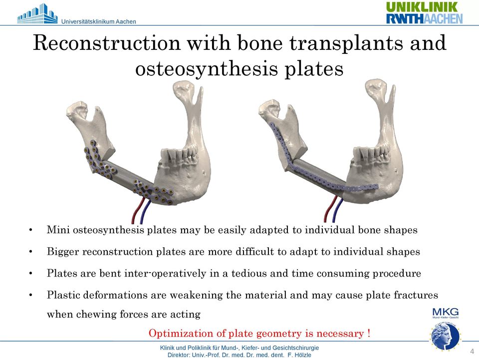 are bent inter-operatively in a tedious and time consuming procedure Plastic deformations are weakening the