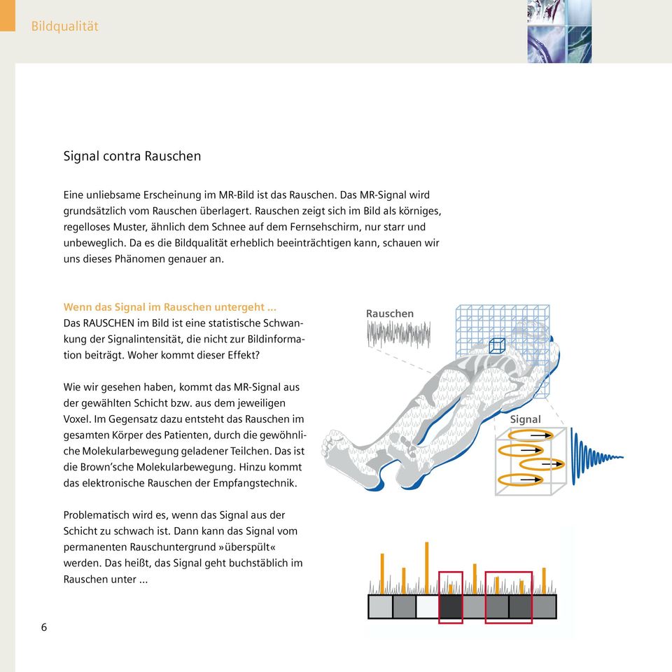 Da es die Bildqualität erheblich beeinträchtigen kann, schauen wir uns dieses Phänomen genauer an. Wenn das Signal im Rauschen untergeht.