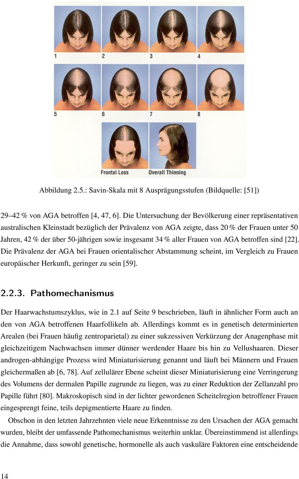 34 % aller Frauen von AGA betroffen sind [22]. Die Prävalenz der AGA bei Frauen orientalischer Abstammung scheint, im Vergleich zu Frauen europäischer Herkunft, geringer zu sein [59]. 2.2.3. Pathomechanismus Der Haarwachstumszyklus, wie in 2.