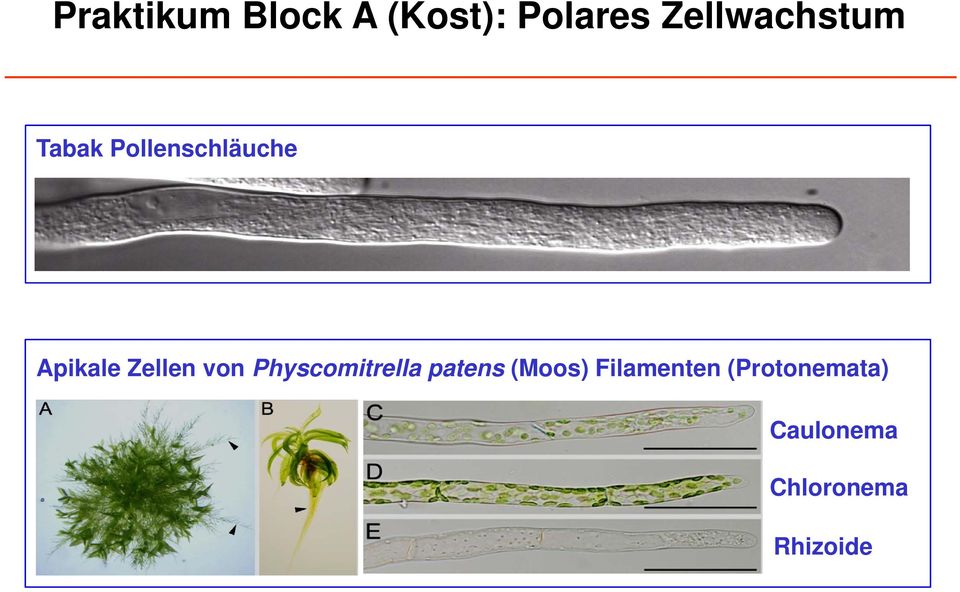Zellen von Physcomitrella patens (Moos)