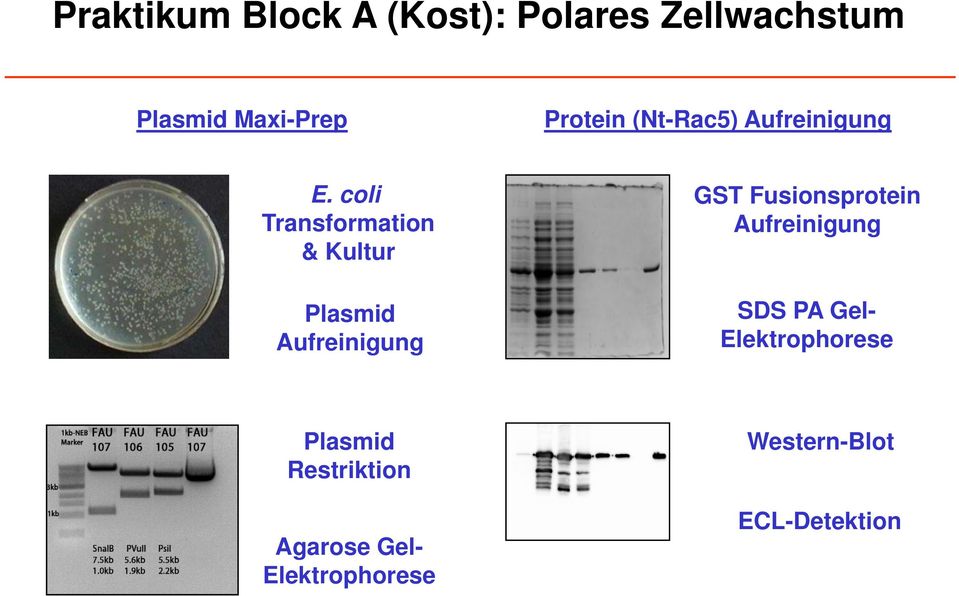 coli Transformation & Kultur Plasmid Aufreinigung GST Fusionsprotein