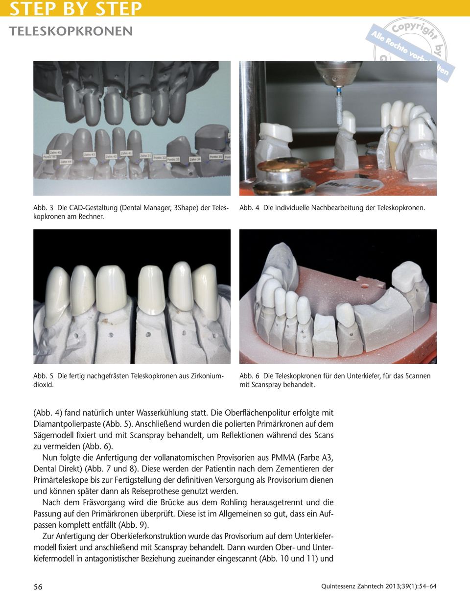 5). Anschließend wurden die polierten Primärkronen auf dem Sägemodell fixiert und mit Scanspray behandelt, um Reflektionen während des Scans zu vermeiden (Abb. 6).