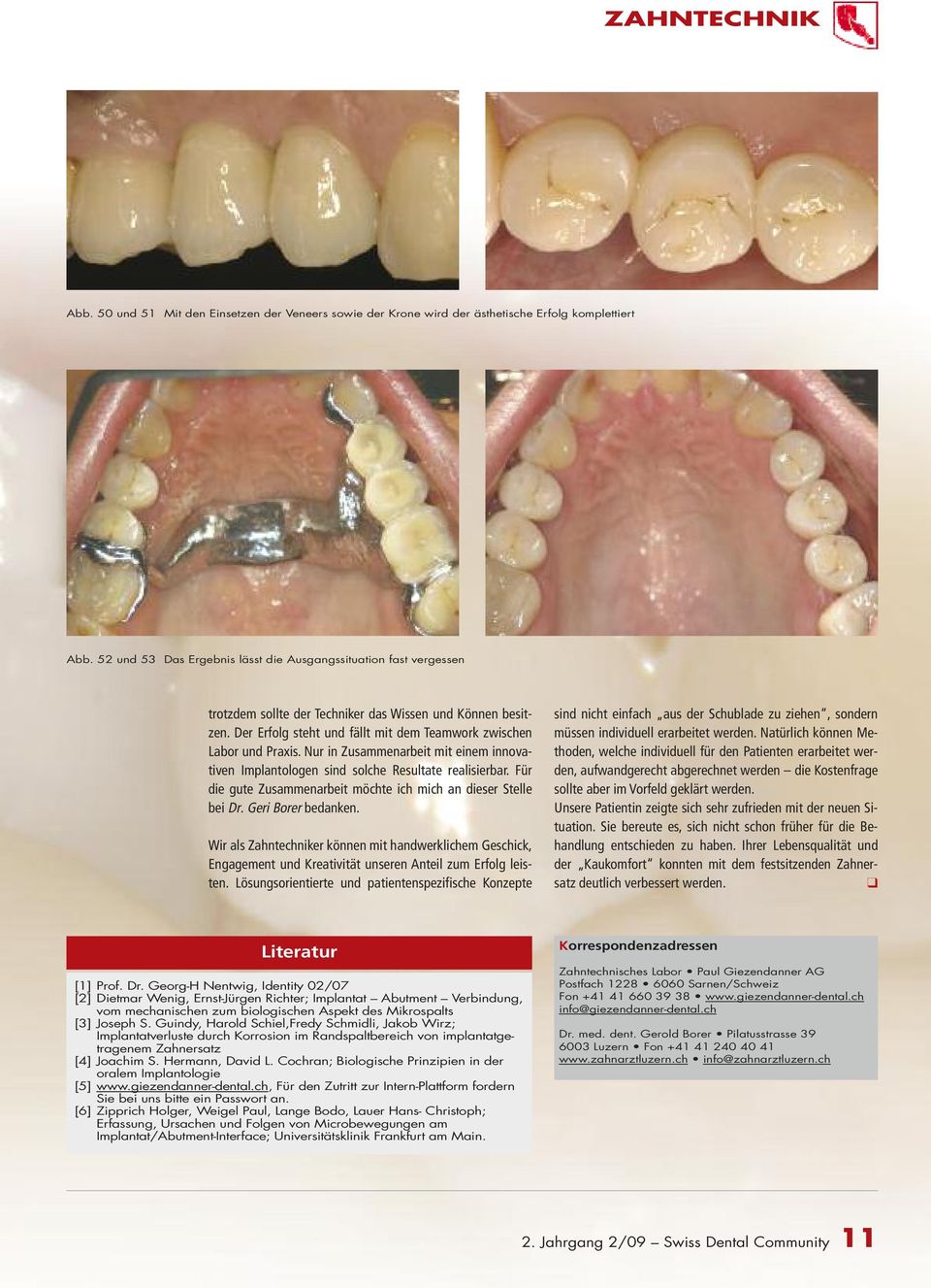 Nur in Zusammenarbeit mit einem innovativen Implantologen sind solche Resultate realisierbar. Für die gute Zusammenarbeit möchte ich mich an dieser Stelle bei Dr. Geri Borer bedanken.