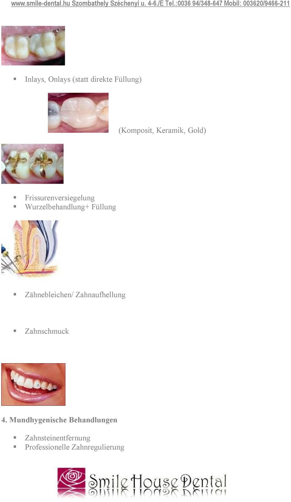 Zähnebleichen/ Zahnaufhellung Zahnschmuck 4.