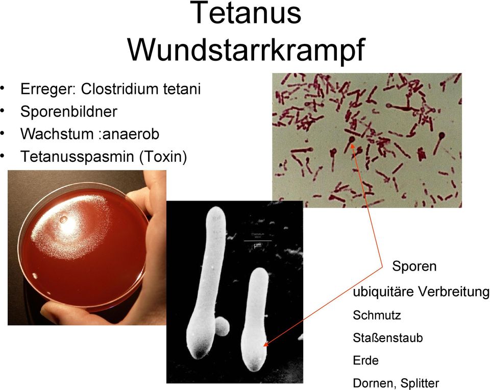 Tetanusspasmin (Toxin) Sporen ubiquitäre