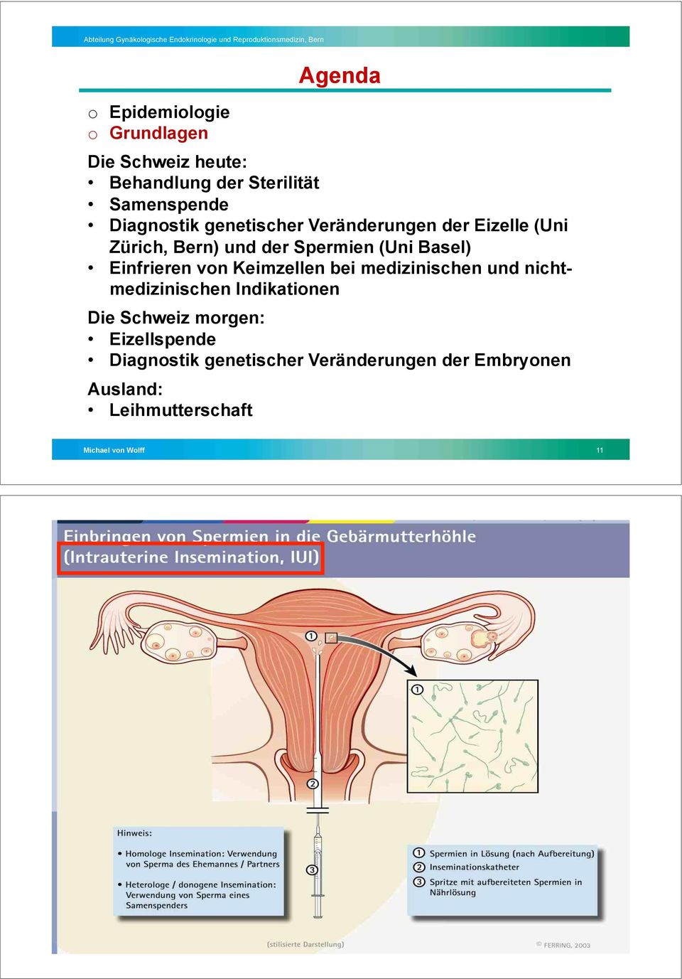 Keimzellen bei medizinischen und nichtmedizinischen Indikationen Die Schweiz morgen: Eizellspende