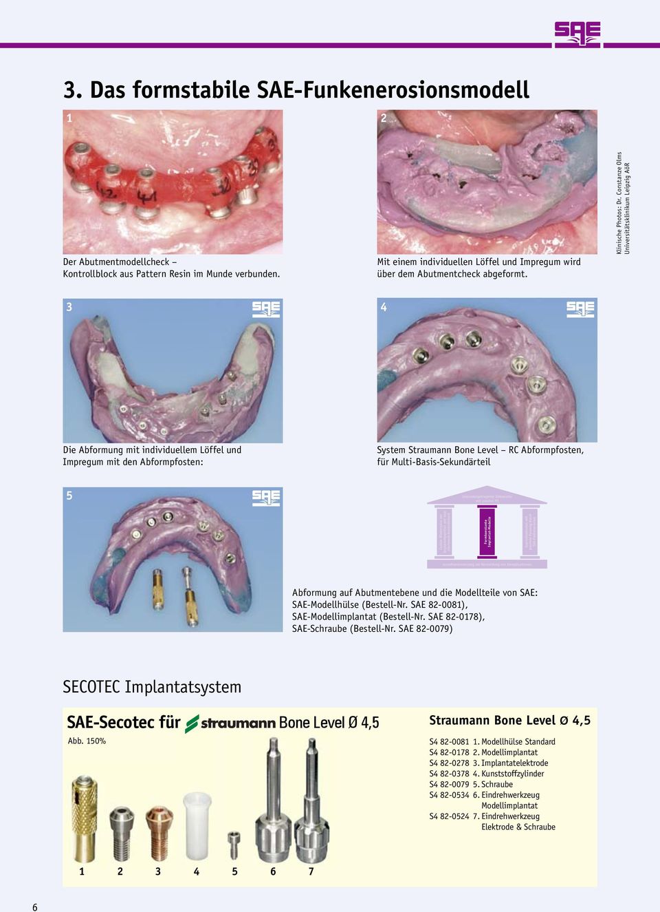 Constanze Olms Universitätsklinikum Leipzig AöR 3 4 Die Abformung mit individuellem Löffel und Impregum mit den Abformpfosten: System Straumann Bone Level RC Abformpfosten, für