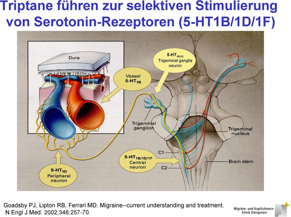 ganglia neuron Goadsby PJ, Lipton RB, Ferrari MD.