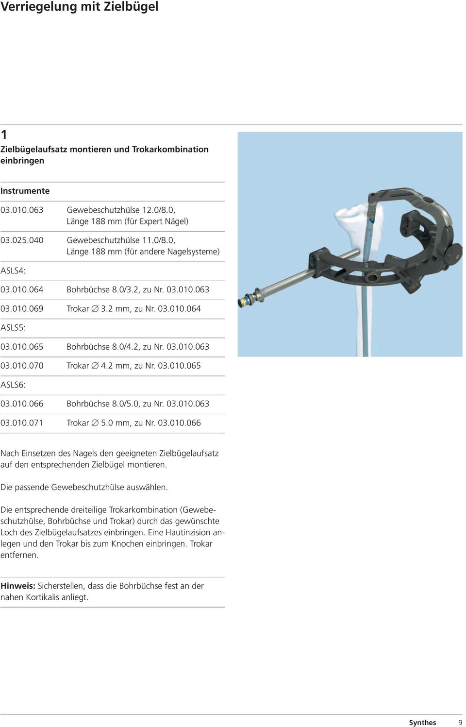 0/4.2, zu Nr. 03.010.063 03.010.070 Trokar 4.2 mm, zu Nr. 03.010.065 ASLS6: 03.010.066 Bohrbüchse 8.0/5.0, zu Nr. 03.010.063 03.010.071 Trokar 5.0 mm, zu Nr. 03.010.066 Nach Einsetzen des Nagels den geeigneten Zielbügelaufsatz auf den entsprechenden Zielbügel montieren.