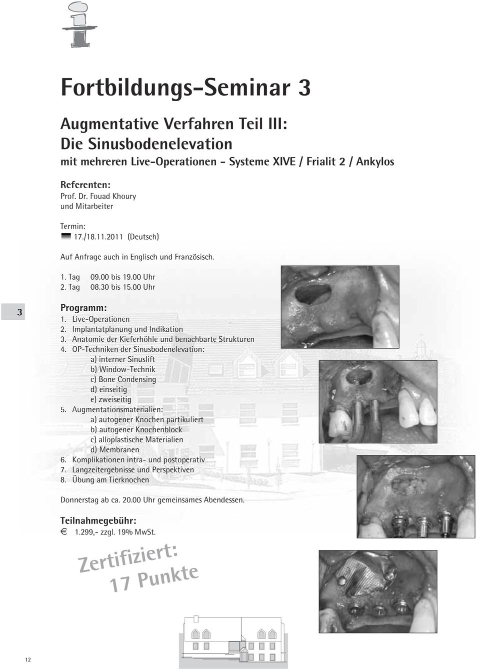 Implantatplanung und Indikation 3. Anatomie der Kieferhöhle und benachbarte Strukturen 4.