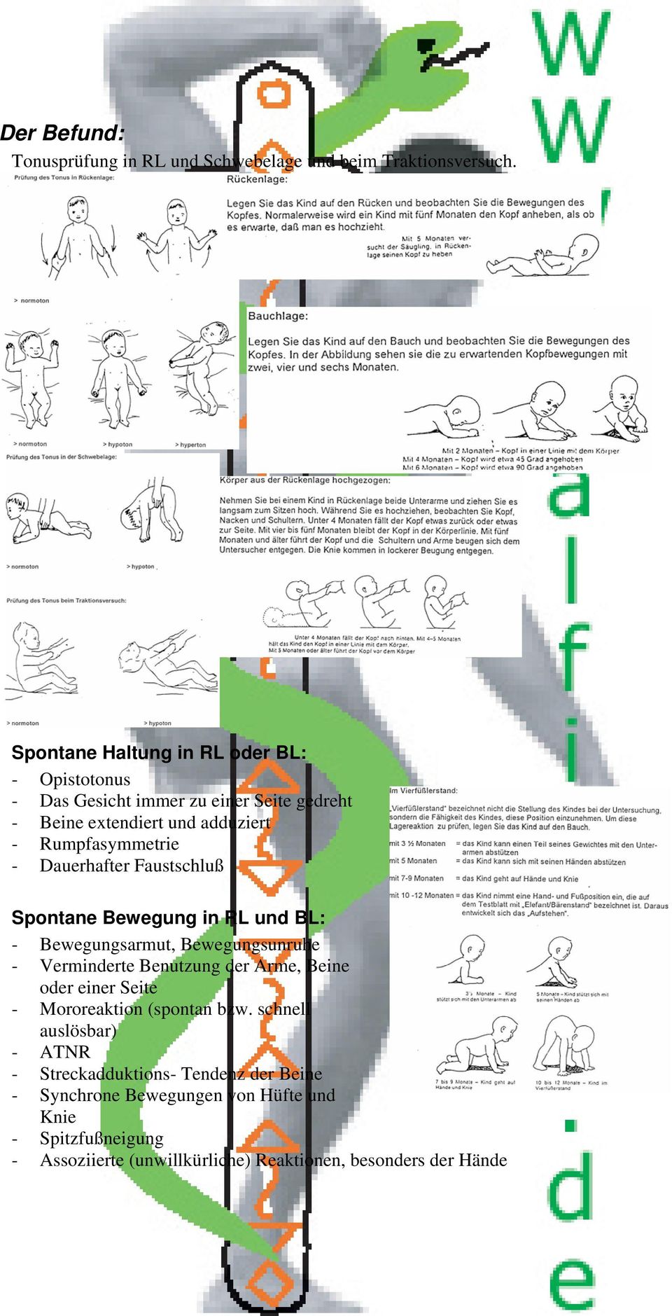 Dauerhafter Faustschluß Spontane Bewegung in RL und BL: - Bewegungsarmut, Bewegungsunruhe - Verminderte Benutzung der Arme, Beine oder einer