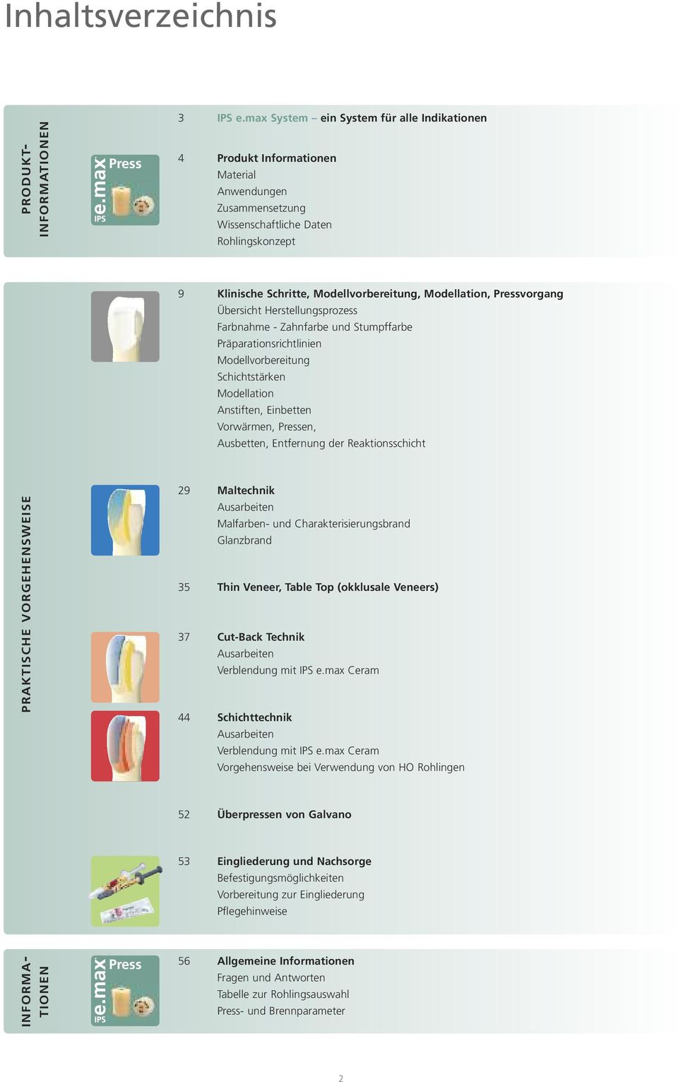 Pressvorgang Übersicht Herstellungsprozess Farbnahme - Zahnfarbe und Stumpffarbe Präparationsrichtlinien Modellvorbereitung Schichtstärken Modellation Anstiften, Einbetten Vorwärmen, Pressen,