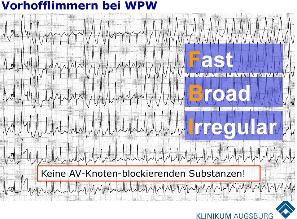 AV-Knoten-blockierenden