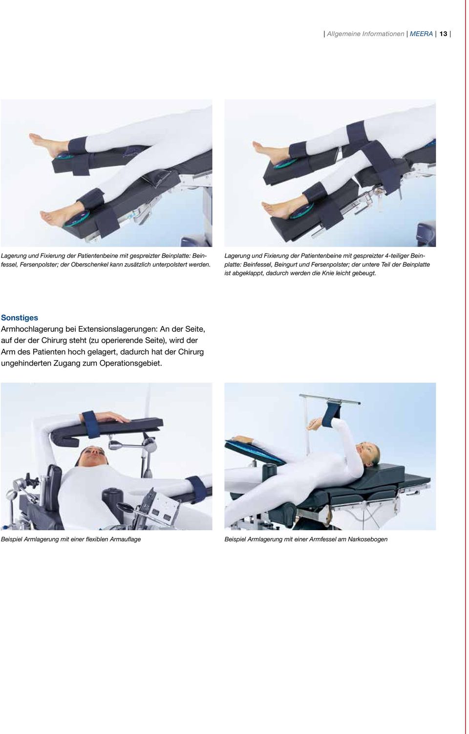 Lagerung und Fixierung der Patientenbeine mit gespreizter 4-teiliger Beinplatte: Beinfessel, Beingurt und Fersenpolster; der untere Teil der Beinplatte ist abgeklappt, dadurch