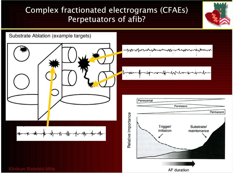 electrograms