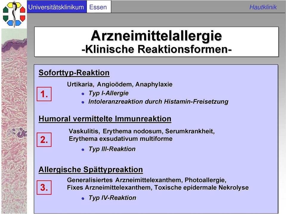 Intoleranzreaktion durch Histamin-Freisetzung Humoral vermittelte Immunreaktion 2.