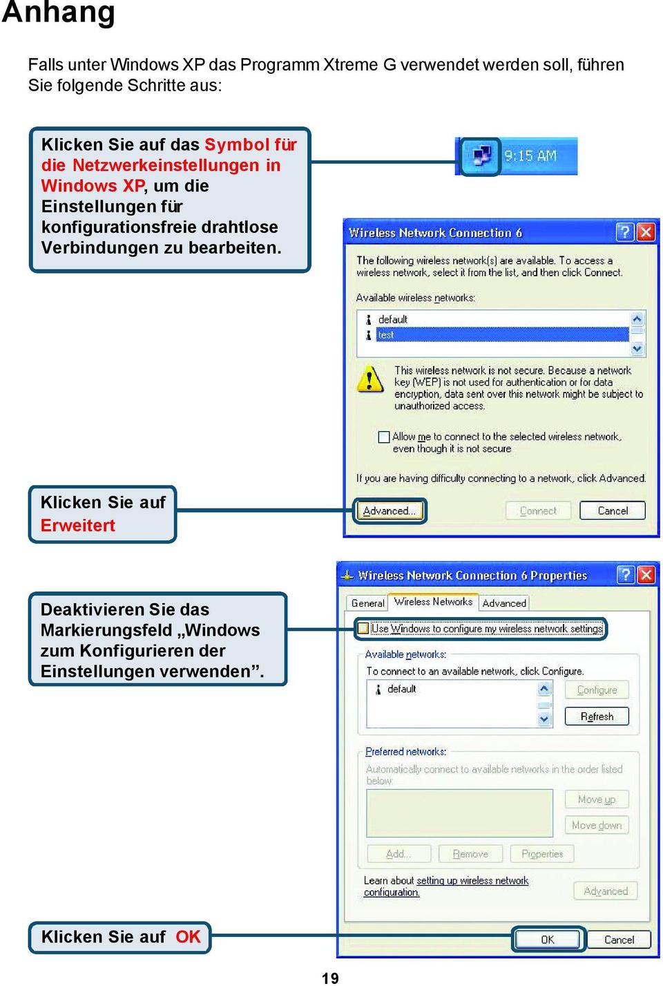 Einstellungen für konfigurationsfreie drahtlose Verbindungen zu bearbeiten.