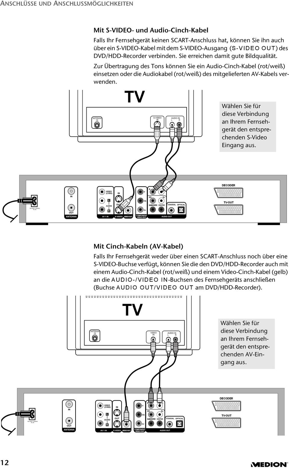 Zur Übertragung des Tons können Sie ein Audio-Cinch-Kabel (rot/weiß) einsetzen oder die Audiokabel (rot/weiß) des mitgelieferten AV-Kabels verwenden.