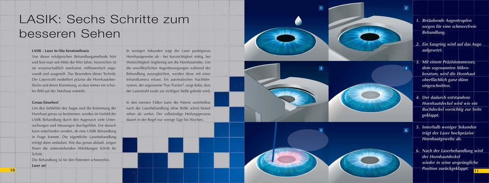 Das Besondere dieser Technik: Der Laserstrahl modelliert präzise die Hornhautoberfläche und deren Krümmung, so dass immer ein scharfes Bild auf der Netzhaut entsteht. Genau hinsehen!