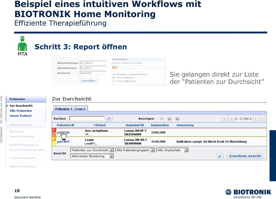 Therapieführung MTA Schritt 3: Report öffnen