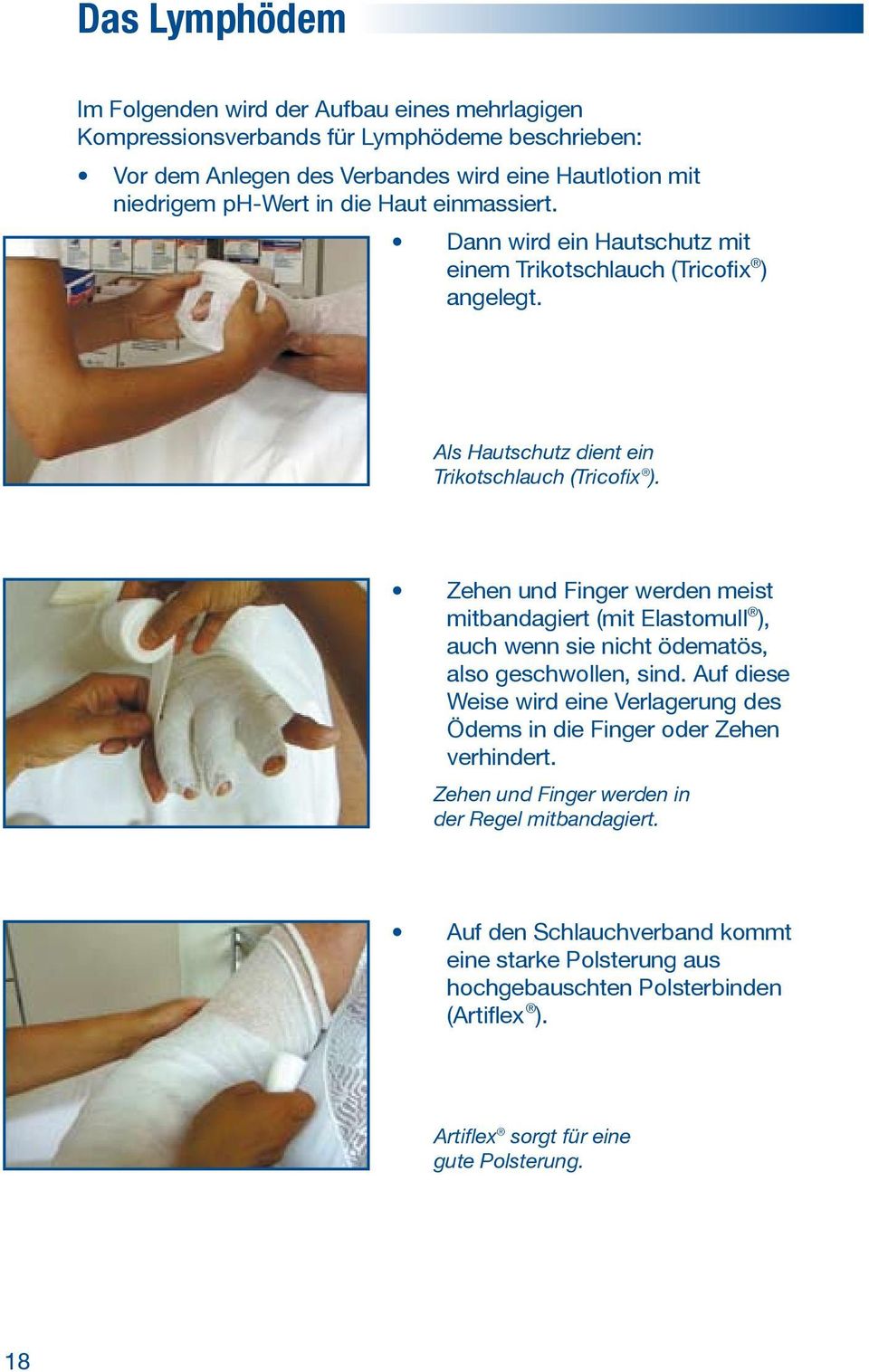 Zehen und Finger werden meist mitbandagiert (mit Elastomull ), auch wenn sie nicht ödematös, also geschwollen, sind.