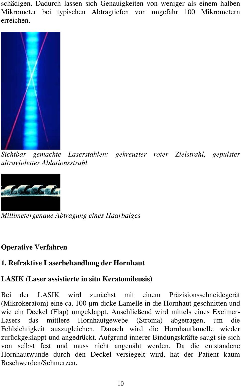 Refraktive Laserbehandlung der Hornhaut LASIK (Laser assistierte in situ Keratomileusis) Bei der LASIK wird zunächst mit einem Präzisionsschneidegerät (Mikrokeratom) eine ca.