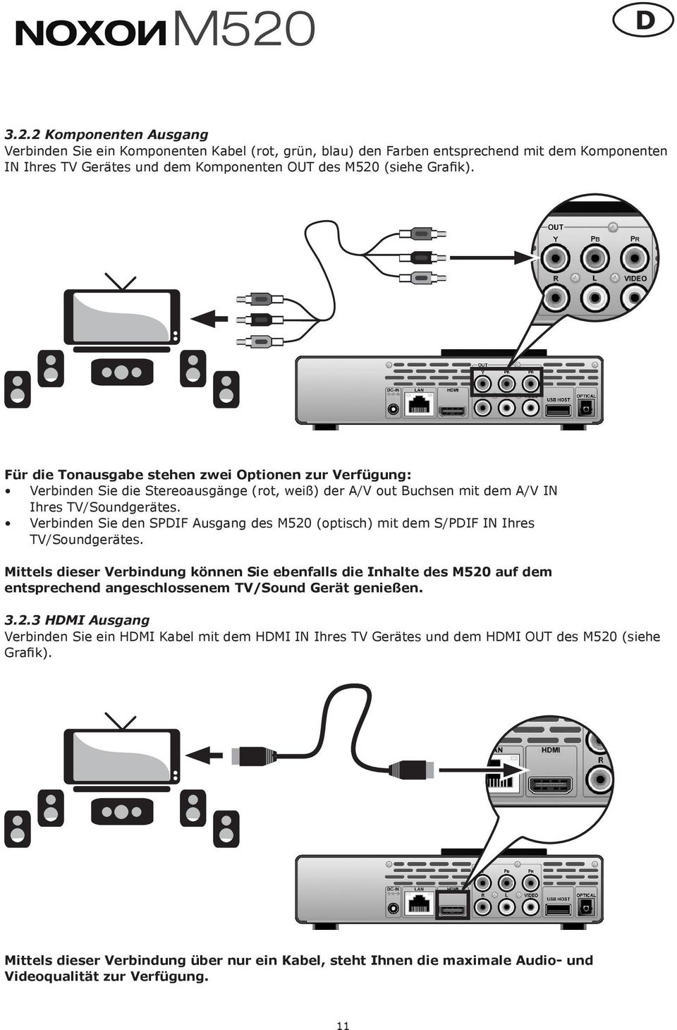 Verbinden Sie den SPDIF Ausgang des M520 (optisch) mit dem S/PDIF IN Ihres TV/Soundgerätes.