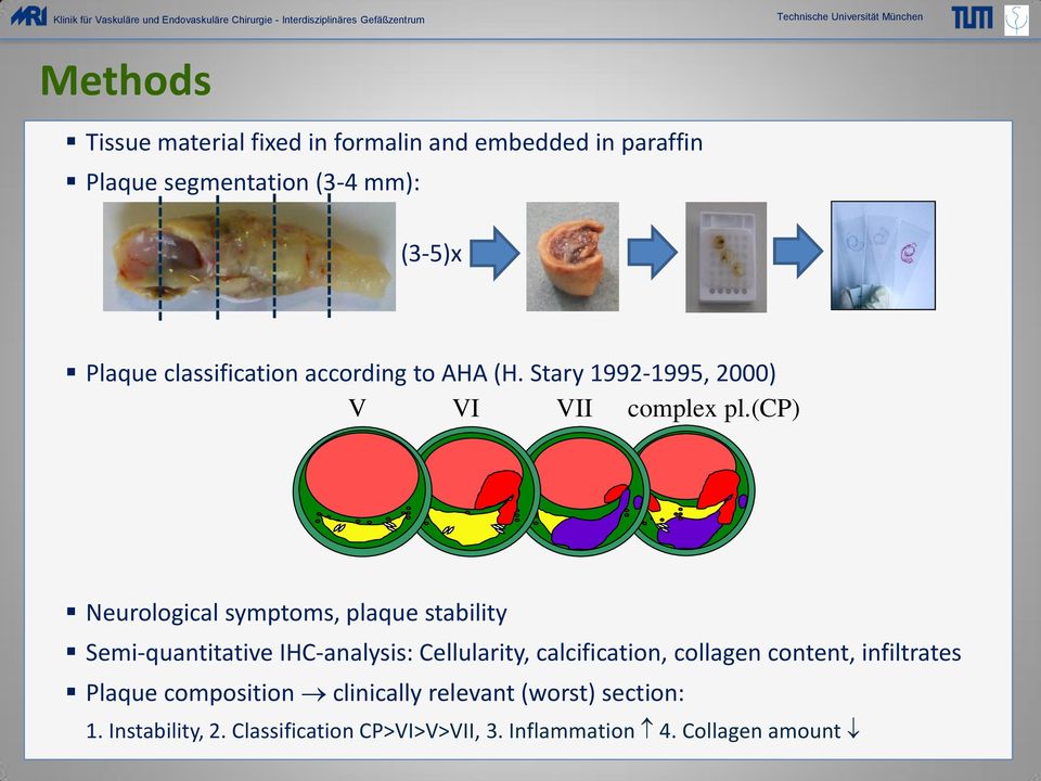 (cp) Neurological symptoms, plaque stability Semi-quantitative IHC-analysis: Cellularity, calcification, collagen